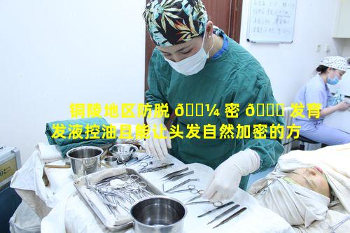 铜陵地区防脱 🌼 密 🐟 发育发液控油且能让头发自然加密的方法有哪些呢
